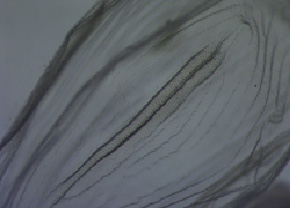 Mikroskopische Aufnahme des weiblichen Genitals des Baumwollkapselwurms