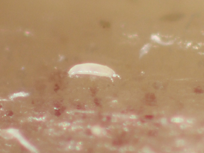 Mikroskopische Aufnahme einer Knoblauchgallmilbe