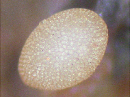 Mikroskopische Aufnahme des ovalen, beigefarbenen Eies 