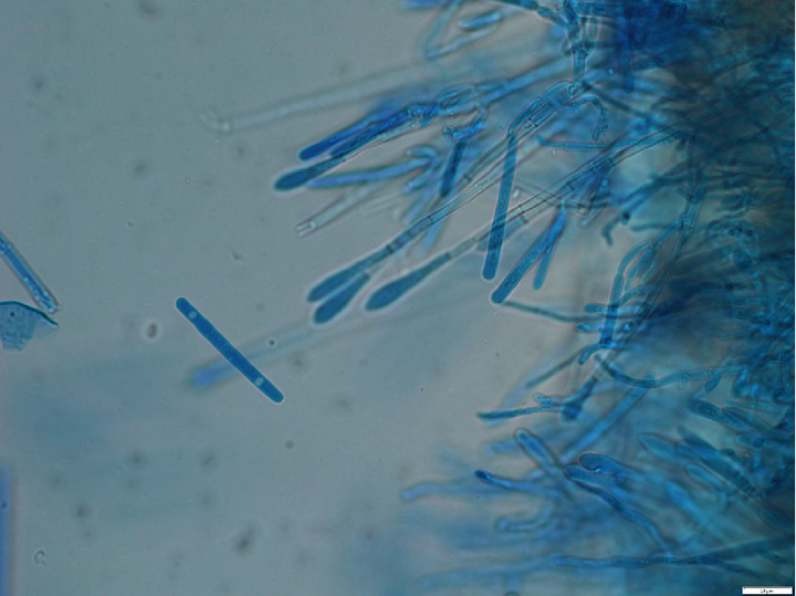 Mikroskopische Aufnahme der Konidien von C. buxicola