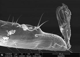 Sensory pit on the anteriormost tick leg  (Enlarges Image in Dialog Window)